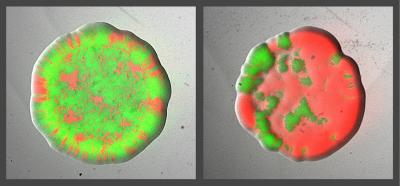 Strain Images