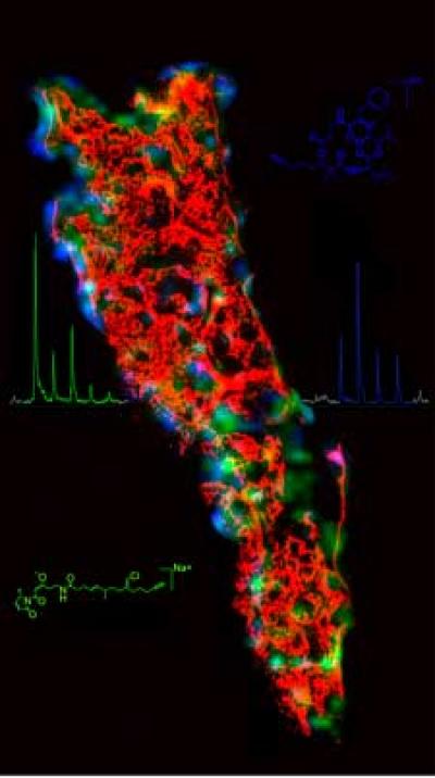 A Thin Section of Marine Sponge