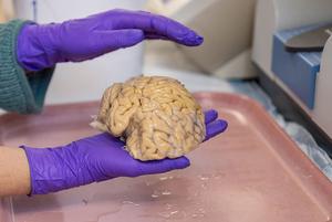 Scientist holds donated SuperAger brain