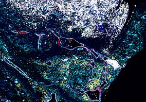Mapping the biology of neuroblastoma.