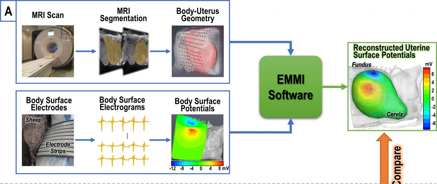 Noninvasive Imaging Reconstructs Electrical Patterns in Uterus During Contractions (1 of 3)