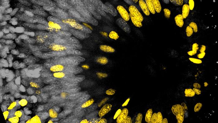 Fig. 2: View onto a worm's eye with dividing cells stained in yellow.