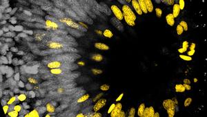 Fig. 2: View onto a worm's eye with dividing cells stained in yellow.