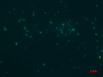 Archaea -- An Overlooked Source of Greenhouse Gas