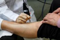 Diagnosis of Melanoma