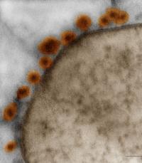 Zika Virus Particles Bounded to the Membrane in Human iPS Cell-Derived Neurosphere