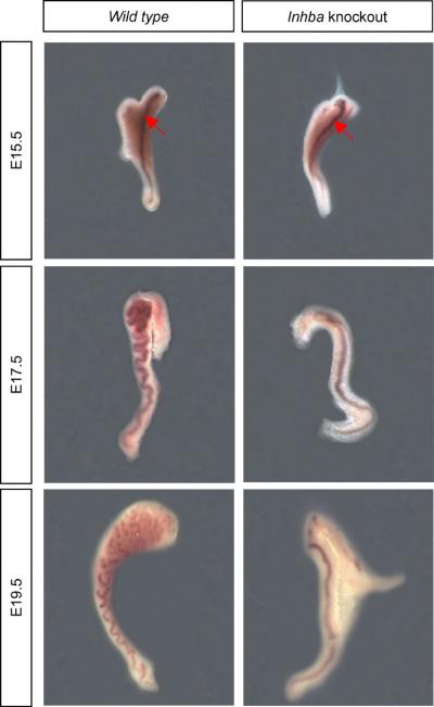 Mutant and Wild Type Wolffian Duct Development