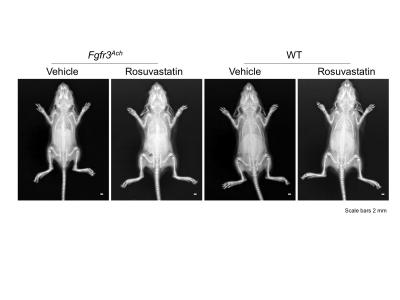 Statin Effects on Bone Growth in Wild Type and ACH Model Mice