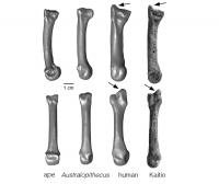 Styloid Process