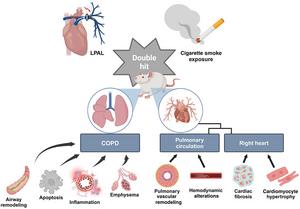 Novel Rat Model Paves the Way to Advance COPD-Associated Cor Pulmonale Research