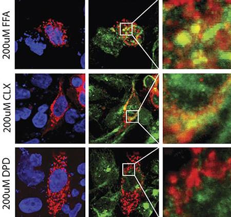 Drug Interaction with TAS2R14 Receptor