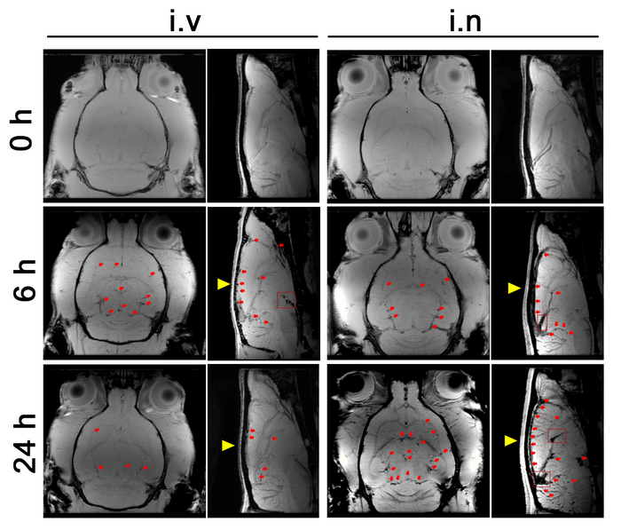 MRI of rat brains after delivery of nanoparticles