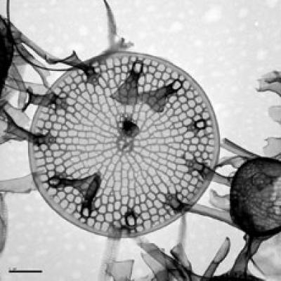 <I>Skeletonema marinoi</I>