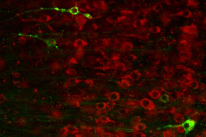 Antisense Oligos for Tau