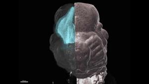 Video of mouse brain