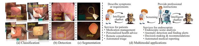 How AI Is Reshaping Colonoscopy