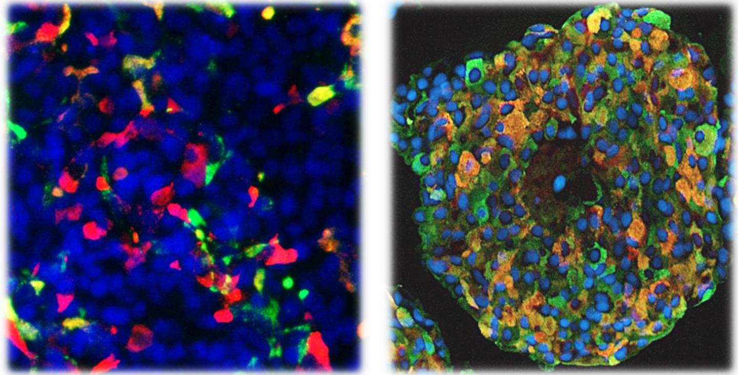 Cells with An Activating STAT3 Mutation Differentiate into Insulin-Producing Cells in the Pancreas