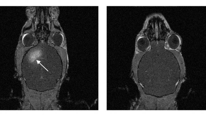 Focused-Ultrasound Enables Transient BBB Opening
