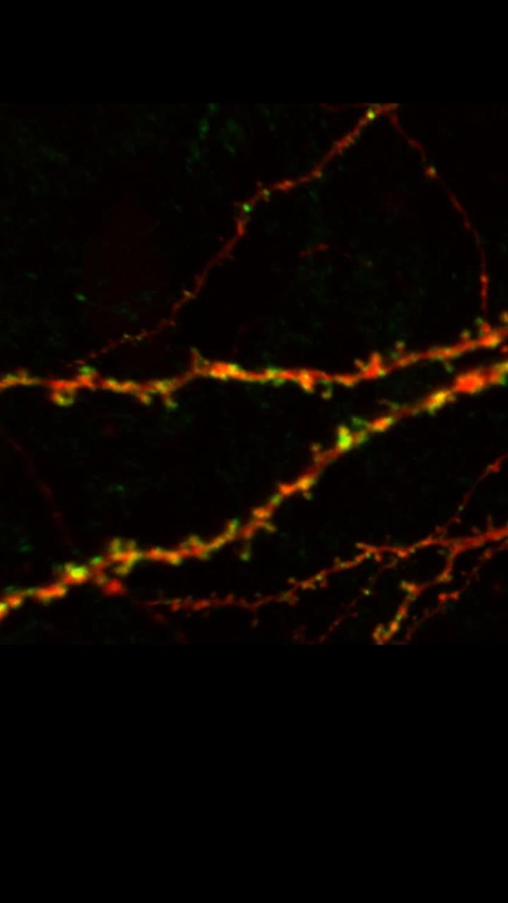 Carnegie Mellon Receives $7.5 Million in Federal BRAIN Initiative Funding