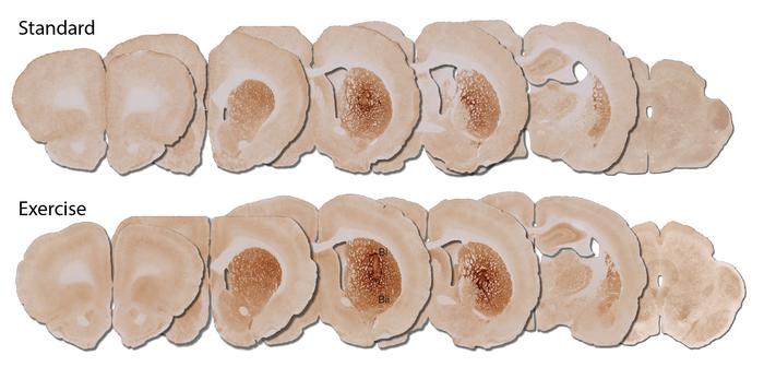 Exercise enhances stem cell transplant function in Parkinson’s disease