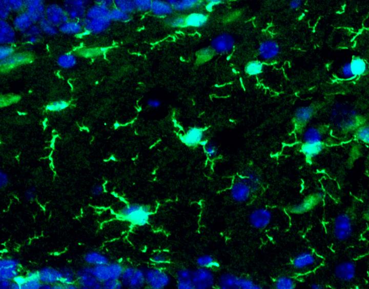 Microglia