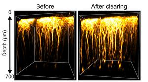 Three-dimensional fluorescence images of neurons in the brain of a live mouse, before and after clearing