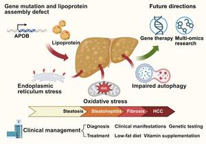 Current and Emerging Issues in Familial Hypobetalipoproteinemia-related Steatotic Liver Diseases
