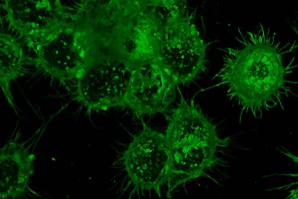 Tapping the power of glycans for better cancer treatments