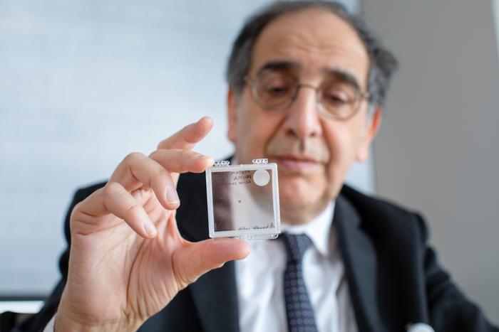 José-Alain Sahel, M.D., holding the PRIMA implant