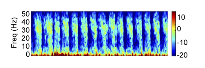 Rhythms of Ketamine