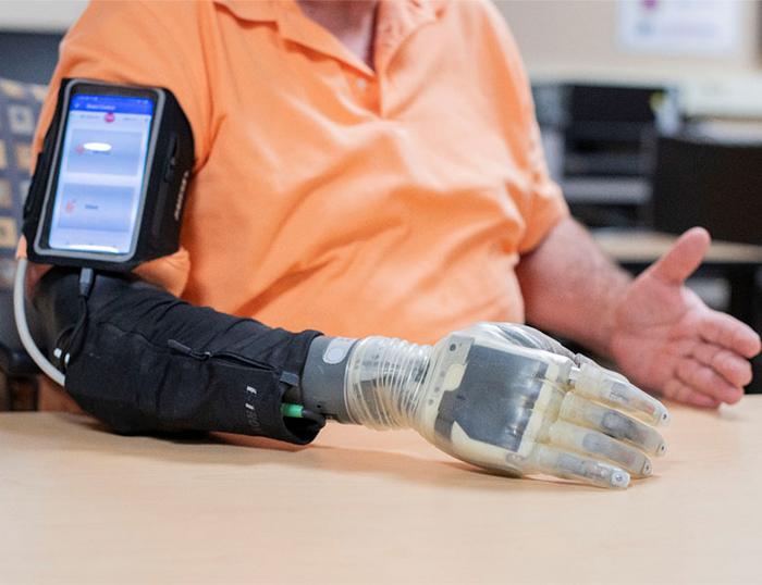 CWRU neuroprosthesis