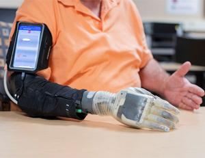 CWRU neuroprosthesis