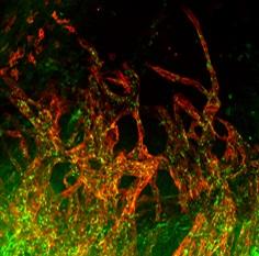 New Lymphatic Vessel Growth, Seen under a Microscope