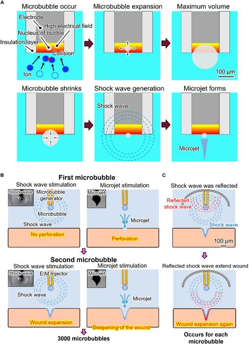 The principle of needle-free injection based on the reflection of shock waves through microbubble dynamics.