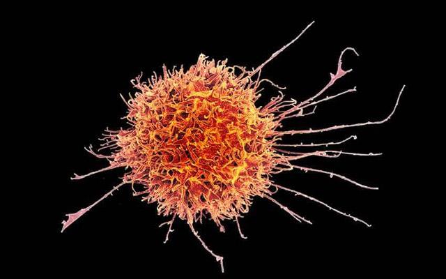 Natural Killer Cell