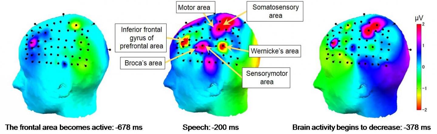 Shift in Brain Activity