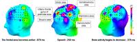 Shift in Brain Activity