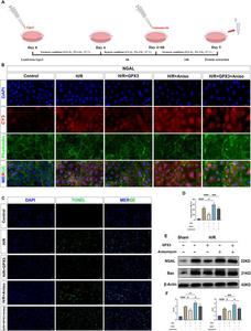 Anisomycin reverses the protective effect of selenoprotein GPX3.