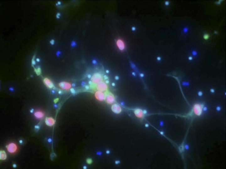 Ovarian Cancer Trapped in DNA Webs