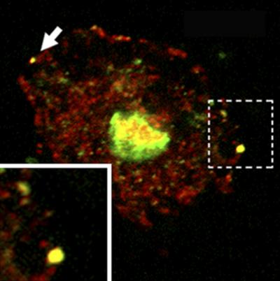 Hiv Gag Protein Localizes to Autophagosomes
