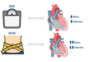 Pictogram showing the results of the research - ‘Beer Belly’ Linked to Heart Damage in Men