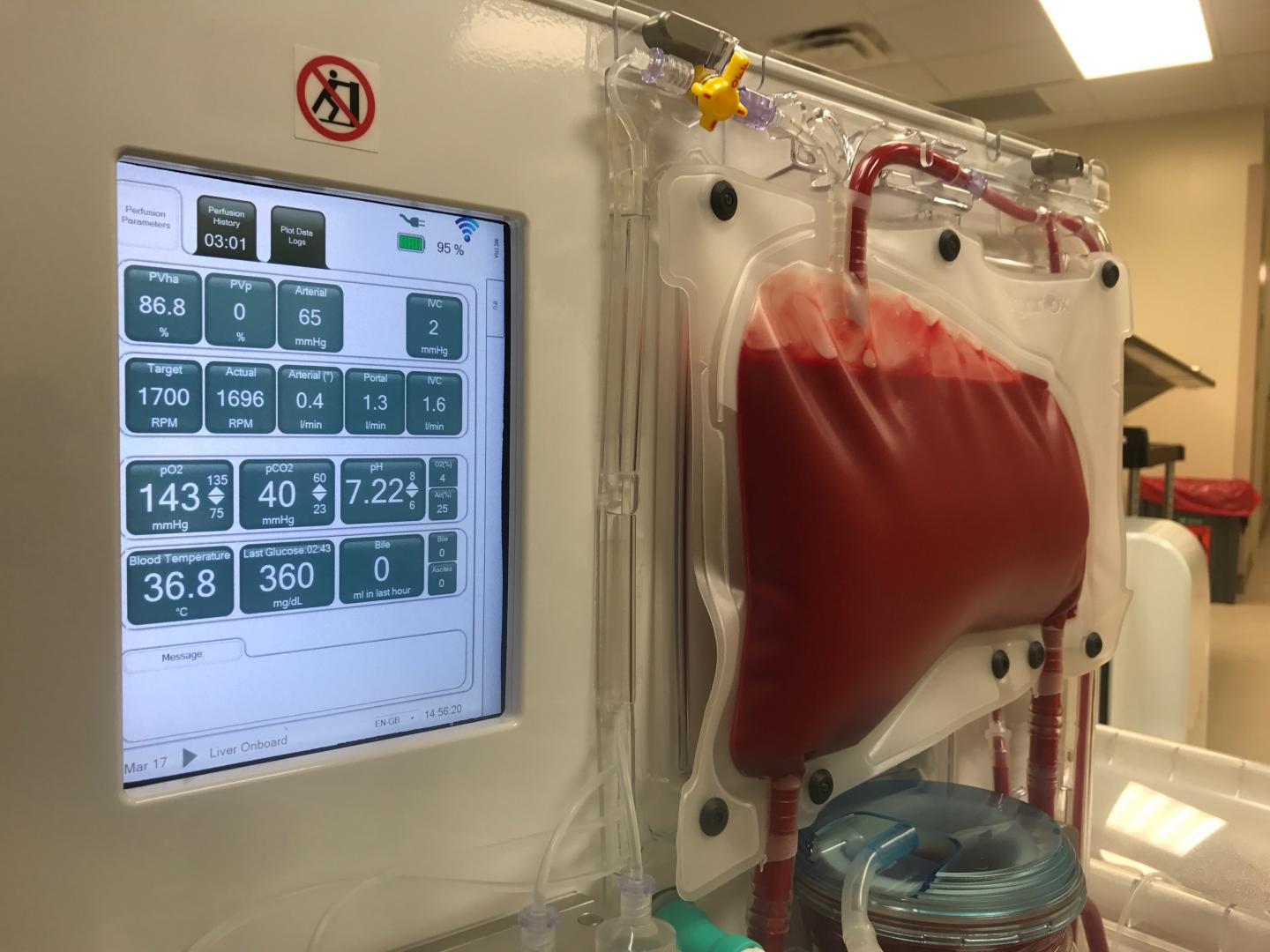 Normothermic Perfusion Machine 2