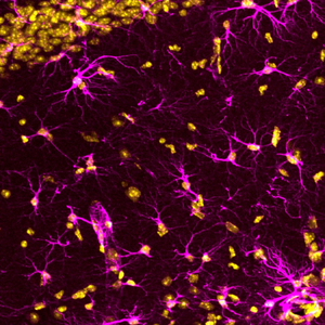 Astrocytes