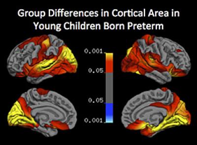 Brain Image
