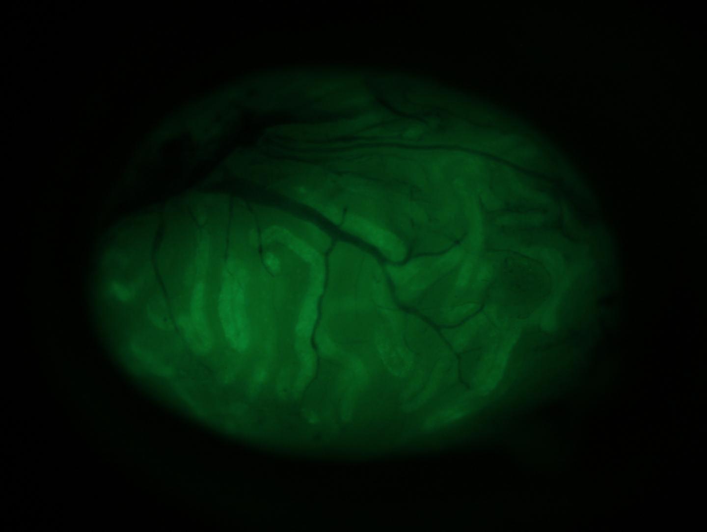 Congenitally infertile Cldn11 KO testis transplanted with Cldn11 KO testis cells.