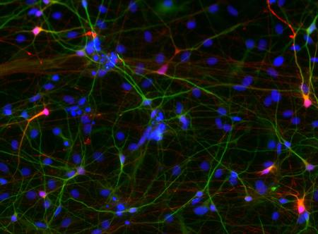 Ideopathic Neurons