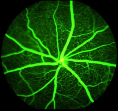 Proteins Critical to Wound Healing Identified