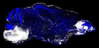 Movies Reveal Cause of Death from Cerebral Malaria