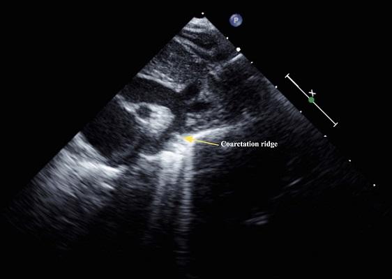 Ultrasound Image