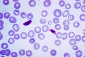 Study reveals an immune evasion strategy used by Plasmodium